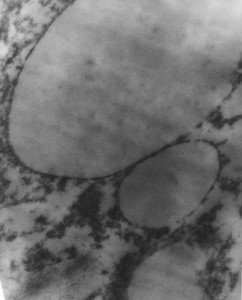 TEM of wiener emulsion